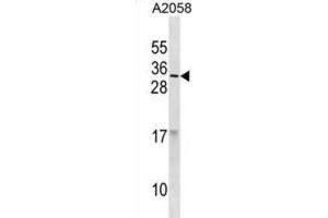 Western Blotting (WB) image for anti-Ribonuclease, RNase A Family, 9 (Non-Active) (RNASE9) antibody (ABIN3001184) (RNASE9 抗体)