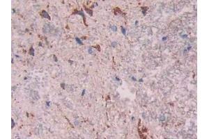 Detection of CTSD in Rat Spinal cord Tissue using Polyclonal Antibody to Cathepsin D (CTSD)