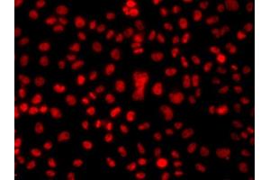 Immunofluorescence analysis of  cells using hnRNP  antibody (ABIN6128029, ABIN6141896, ABIN6141899 and ABIN6223388). (HNRNPA1 抗体  (AA 1-372))