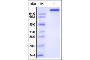 Rhesus macaque EGF R, Fc Tag on SDS-PAGE under reducing (R) condition. (EGFR Protein (AA 25-645) (Fc Tag))