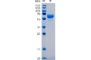 SDS-PAGE (SDS) image for Sialic Acid Binding Ig-Like Lectin 15 (SIGLEC15) (AA 20-263) protein (mFc-His Tag) (ABIN6961145)