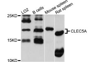 Western blot analysis of extracts of various cell lines, using CLEC5A antibody (ABIN5971486) at 1/1000 dilution. (CLEC5A 抗体)