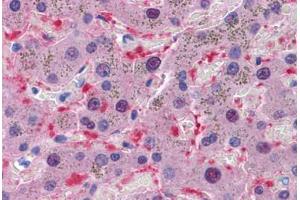 Human Liver: Formalin-Fixed, Paraffin-Embedded (FFPE)