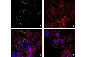 Immunocytochemistry staining of lysozyme (green, A, C) in Hep G2 cells (A, B, C) using mouse monoclonal antibody LZ598-10G9. (LYZ 抗体)