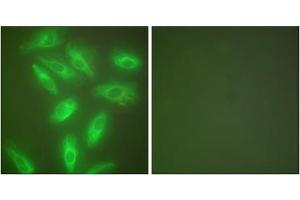 Immunofluorescence analysis of HeLa cells, using Keratin 18 antibody (ABIN5976438). (Cytokeratin 18 抗体  (C-Term))