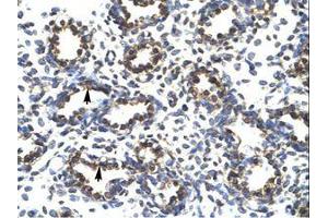 Image no. 1 for anti-PR Domain Containing 14 (PRDM14) (AA 208-257) antibody (ABIN202775) (PRDM14 抗体  (AA 208-257))