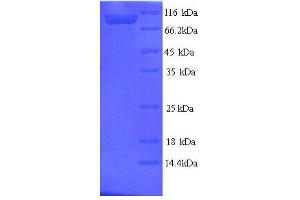 SDS-PAGE (SDS) image for tau Protein (AA 2-752) protein (His tag) (ABIN5713630)