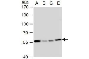 WB Image TCP1 eta antibody [C1C3] detects TCP1 eta protein by western blot analysis. (CCT7 抗体  (C-Term))