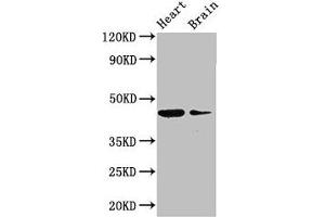 Western Blot Positive WB detected in: Mouse heart tissue, Mouse brain tissue All lanes: P2RX1 antibody at 3 μg/mL Secondary Goat polyclonal to rabbit IgG at 1/50000 dilution Predicted band size: 45 kDa Observed band size: 45 kDa (P2RX1 抗体  (AA 54-175))