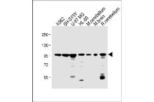 All lanes : Anti-DNAJC6 Antibody (Center) at 1:2000 dilution Lane 1: K562 whole cell lysate Lane 2: SH-SY5Y whole cell lysate Lane 3: U-87 MG whole cell lysate Lane 4: HL-60 whole cell lysate Lane 5: mouse cerebellum lysate Lane 6: mouse brain lysate Lane 7: rat cerebellum lysate Lysates/proteins at 20 μg per lane. (DNAJC6 抗体  (AA 254-281))