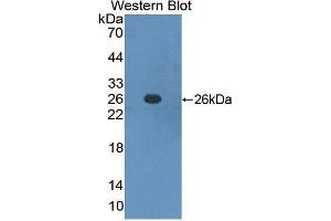 Western Blotting (WB) image for anti-Interferon alpha/beta Receptor 1 (IFNAR1) (AA 28-227) antibody (ABIN1859262) (IFNAR1 抗体  (AA 28-227))
