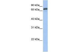 WB Suggested Anti-DYNC1I1 Antibody Titration: 0. (DYNC1I1 抗体  (N-Term))