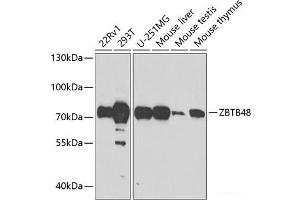 Western blot analysis of extracts of various cell lines using ZBTB48 Polyclonal Antibody at dilution of 1:1000. (ZBTB48 抗体)