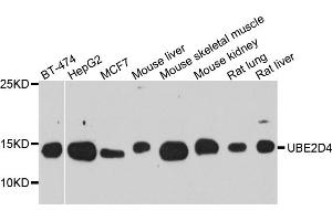 Western blot analysis of extracts of various cell lines, using UBE2D4 antibody (ABIN5974832) at 1/1000 dilution. (UBE2D4 抗体)