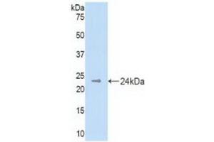 Detection of Recombinant DHH, Mouse using Polyclonal Antibody to Hedgehog Homolog, Desert (DHH) (desert Hedgehog 抗体  (AA 212-392))