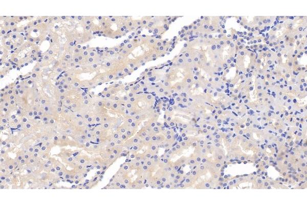 Permeability Glycoprotein 抗体  (AA 999-1277)