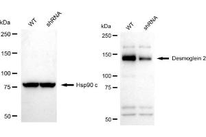 Western blotting analysis using Desmoglein 2 antibody (ABIN7798317). (Recombinant Desmoglein 2 抗体)