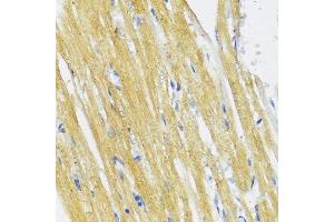 Immunohistochemistry (Paraffin-embedded Sections) (IHC (p)) image for anti-Inhibitor of kappa Light Polypeptide Gene Enhancer in B-Cells, Kinase epsilon (IKBKE) (AA 495-716) antibody (ABIN3020771)