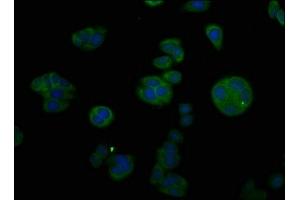 Immunofluorescent analysis of HepG2 cells using ABIN7148441 at dilution of 1:100 and Alexa Fluor 488-congugated AffiniPure Goat Anti-Rabbit IgG(H+L) (CTGF 抗体  (AA 253-349))
