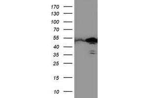 Western Blotting (WB) image for anti-T-Cell Acute Lymphocytic Leukemia 1 (TAL1) antibody (ABIN1501292)