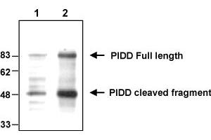 Western blot analysis of endogenous and overexpressed human PIDD using MAb to PIDD (Anto-1) . (PIDD 抗体  (AA 776-910))
