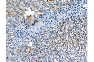 ABIN6260504 and ABIN6279263 at 1/100 staining rat stomach tissue by IHC-P.