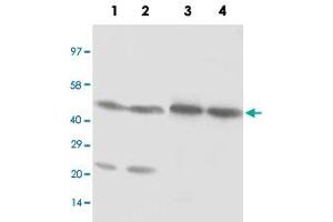 Western blot analysis of cell and tissue lysates with NR1H3 polyclonal antibody . (NR1H3 抗体  (C-Term))