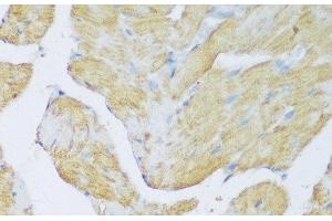 Immunohistochemistry of paraffin-embedded Rat heart using DENR Polyclonal Antibody at dilution of 1:150 (40x lens). (Density Regulated Protein 抗体)