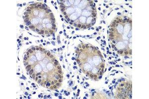 Immunohistochemistry of paraffin-embedded Human colon using GTF2F2 Polyclonal Antibody at dilution of 1:200 (40x lens). (GTF2F2 抗体)