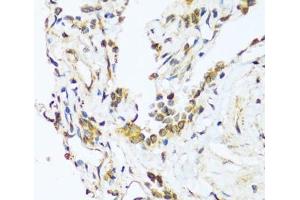 Immunohistochemistry of paraffin-embedded Human lung using BAG3 Polyclonal Antibody at dilution of 1:100 (40x lens). (BAG3 抗体)