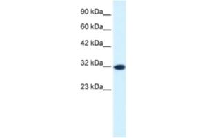 Western Blotting (WB) image for anti-Empty Spiracles Homeobox 2 (EMX2) antibody (ABIN2460259)