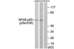 Western blot analysis of extracts from K562 cells and COLO cells, using NF-kappaB p65 (Phospho-Ser536) Antibody. (NF-kB p65 抗体  (pSer536))