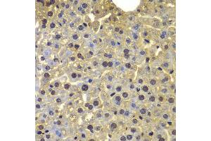 Immunohistochemistry of paraffin-embedded mouse liver using SORT1 antibody at dilution of 1:100 (40x lens). (Sortilin 1 抗体)