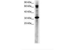 Image no. 3 for anti-TGF-beta Activated Kinase 1/MAP3K7 Binding Protein 2 (TAB2) (N-Term) antibody (ABIN6735781) (TAB2 抗体  (N-Term))