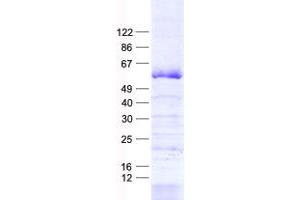 Western Blotting (WB) image for Zinc Finger Protein 35 (ZNF35) protein (His tag) (ABIN2712404)