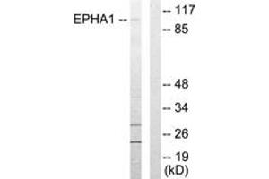 Western blot analysis of extracts from COLO205 cells, using EPHA1 Antibody. (EPHA1 抗体  (AA 541-590))