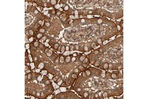 Immunohistochemical staining (Formalin-fixed paraffin-embedded sections) of human small intestine with RPS6KA6 polyclonal antibody  shows strong cytoplasmic and membranous positivity in glandular cells.