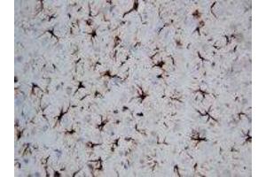 Image no. 1 for anti-Glial Fibrillary Acidic Protein (GFAP) (C-Term) antibody (ABIN1493067) (GFAP 抗体  (C-Term))