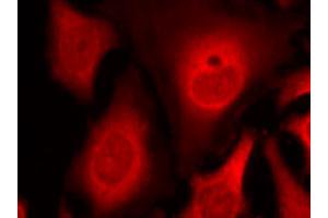 Immunofluorescence staining of methanol-fixed HeLa cells using EIF2S1 (phospho S49) polyclonal antibody (Cat # PAB25902, red). (EIF2S1 抗体  (pSer49))