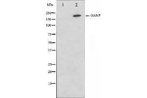Western blot analysis on NIH-3T3 cell lysate using GANP Antibody,The lane on the left is treated with the antigen-specific peptide. (GANP 抗体  (C-Term))