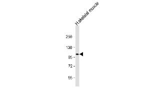 Anti-ATP1A2 Antibody (Center) at 1:2000 dilution + human skeletal muscle lysate Lysates/proteins at 20 μg per lane. (ATP1A2 抗体  (AA 451-479))