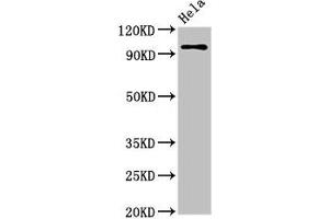 Western Blot Positive WB detected in: Hela whole cell lysate All lanes: CLOCK antibody at 3. (CLOCK 抗体  (AA 577-846))