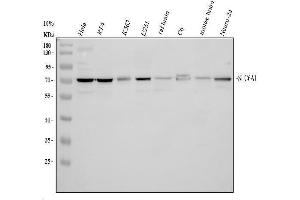 Western blot analysis of SLC6A1 using anti-SLC6A1 antibody (ABIN5518957).