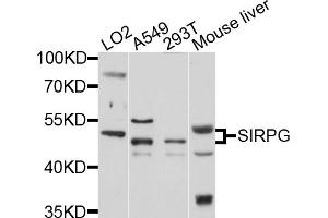 Western blot analysis of extracts of various cell lines, using SIRPG antibody (ABIN1876133) at 1:1000 dilution. (SIRPG 抗体)