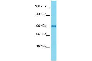 Host: Rabbit Target Name: FSIP2 Sample Type: Placenta lysates Antibody Dilution: 1. (FSIP2 抗体  (C-Term))