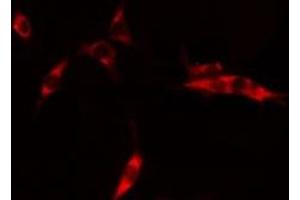 ABIN6275278 staining HepG2 cells by IF/ICC. (CYB5R3 抗体  (C-Term))