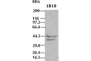 DFF45 antibody (1B10) at 1:500 dilution + Hela cell lysate