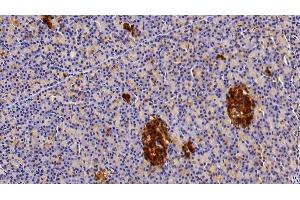Immunohistochemistry (IHC) image for anti-Clusterin (CLU) (AA 229-446) antibody (ABIN7436996)
