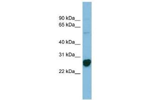 RPL10A antibody used at 1 ug/ml to detect target protein. (RPL10A 抗体  (N-Term))