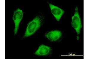 Immunofluorescence of purified MaxPab antibody to HARS on HeLa cell.
